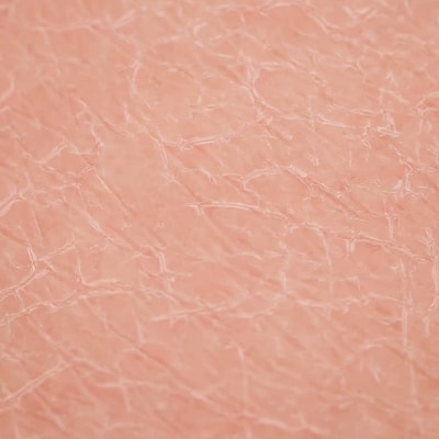 soluzione micellare per pelle secca